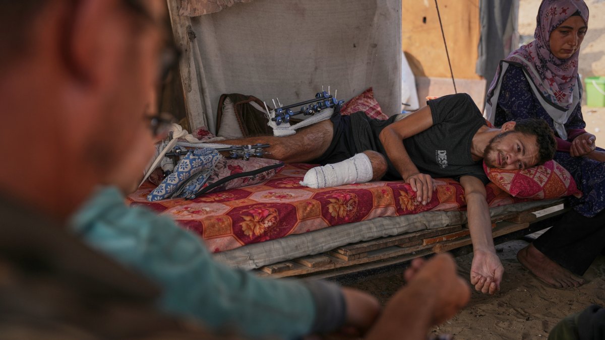 Yassin Marouf, 23, who lost his left foot and suffered a severe injury to his right leg after being hit by Israeli shelling in May, lies in a tent surrounded by his family in Zawaida, central Gaza, Palestine, Nov. 6, 2025. (AP Photo)