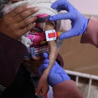 Arjwan al-Dahini, a Palestinian child, who doctors say suffers from severe acute malnutrition, is held by her mother during a medical examination at Nasser Hospital in Khan Younis, southern Gaza Strip, Dec. 16, 2025. (Reuters Photo)