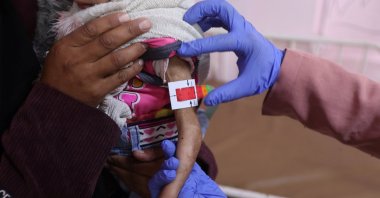 Arjwan al-Dahini, a Palestinian child, who doctors say suffers from severe acute malnutrition, is held by her mother during a medical examination at Nasser Hospital in Khan Younis, southern Gaza Strip, Dec. 16, 2025. (Reuters Photo)