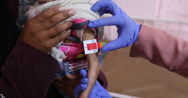 Arjwan al-Dahini, a Palestinian child, who doctors say suffers from severe acute malnutrition, is held by her mother during a medical examination at Nasser Hospital in Khan Younis, southern Gaza Strip, Dec. 16, 2025. (Reuters Photo)