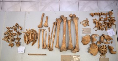 The bones found at the Çayönü Hill excavation were studied to reveal genetic information about the people who lived there 12,000 years ago, Diyarbakır, southeastern Türkiye, Dec. 29, 2025. (AA Photo)