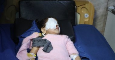 A child injured in the SDF attack receives treatment at a hospital in Aleppo, Syria, Jan. 6, 2026. (AA Photo)