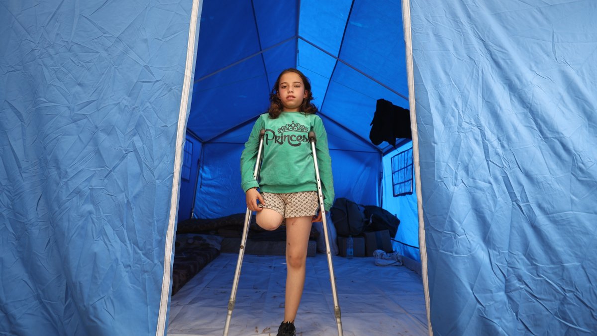Palestinian child who lost leg and family in Israeli attack struggles to survive