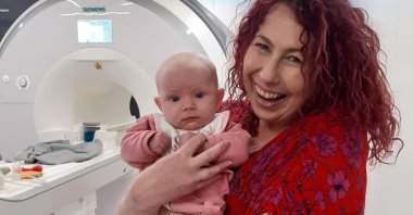 In this undated photo, baby Blaise attends her 2-month Foundcog scan with her mother Mary at Trinity College Institute of Neuroscience in Dublin, Ireland. (AP Photo)