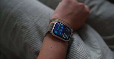 An Apple Watch owner checks their sleep habits, Georgia, U.S., Jan. 21, 2026. (AP Photo)