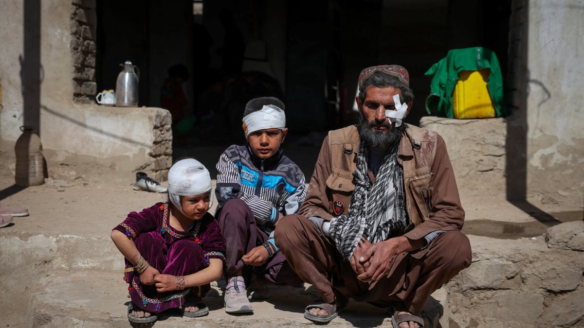 Mohammad Feraidoon, his son Aqeel and daughter Nazanin, who were injured in what the Taliban said was a Pakistani air strike, sit outside their damaged house on the outskirts of Kabul, Afghanistan, March 13, 2026. (Reuters Photo)