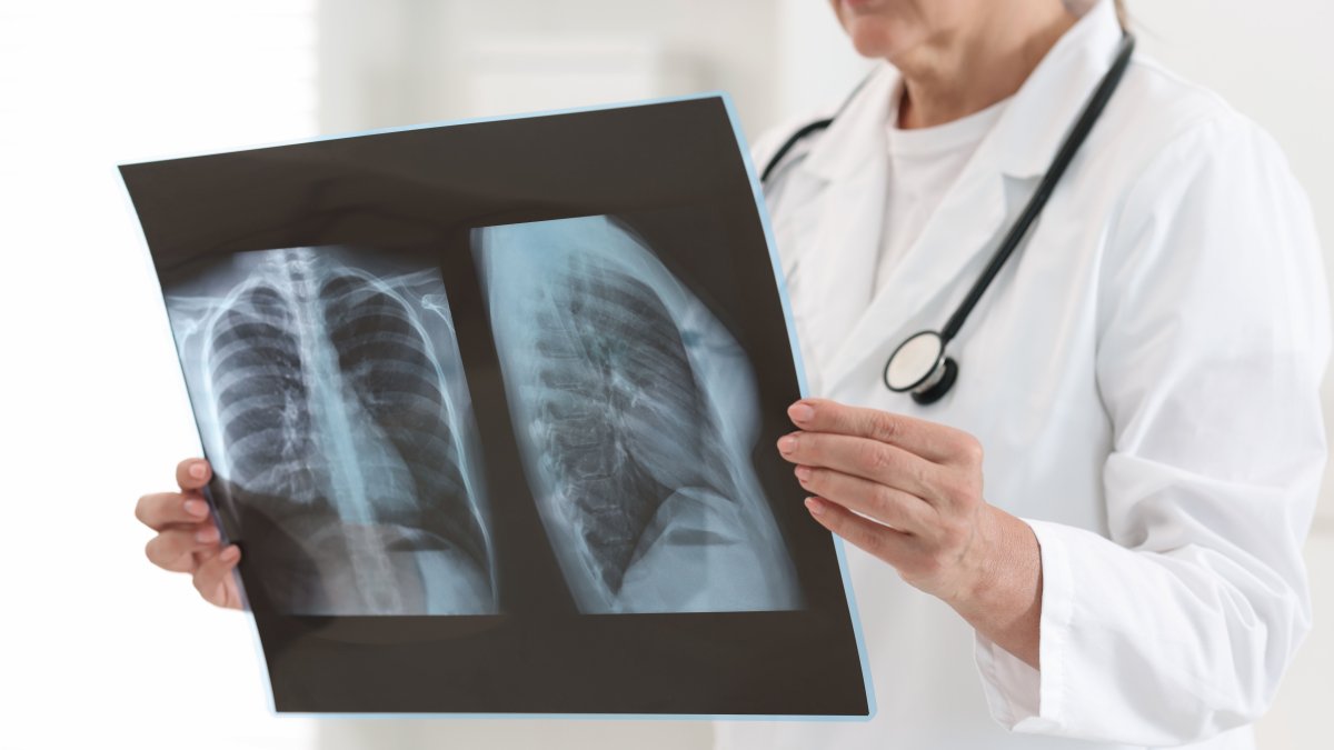 A doctor reviews a patient’s chest X-ray in a clinic. (Shutterstock Photo)