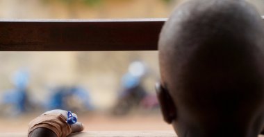 A child living with HIV, wearing an intravenous (IV) cannula in the hand, looks on at the Federal Medical Centre in Makurdi, Benue State, Nigeria, Feb. 11, 2026. (Reuters Photo)