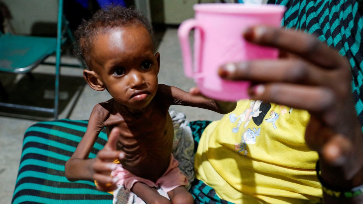 Saddam Najwa, a malnourished, 17-month-old internally displaced child, reaches out for a cup of water at the pediatric ward of a hospital in Gidel, near Kauda, South Kordofan, Sudan, June 25, 2024. (Reuters Photo)