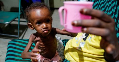 Saddam Najwa, a malnourished, 17-month-old internally displaced child, reaches out for a cup of water at the pediatric ward of a hospital in Gidel, near Kauda, South Kordofan, Sudan, June 25, 2024. (Reuters Photo)