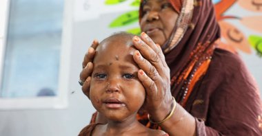 An internally displaced Somali woman holds the head of her malnourished child at the Daynile hospital as shortages of lifesaving therapeutic foods caused by shipping disruptions due to the Iran war have forced clinics treating severely malnourished children to turn away patients and ration supplies, Daynile district of Mogadishu, Somalia, April 20, 2026. (Reuters Photo)