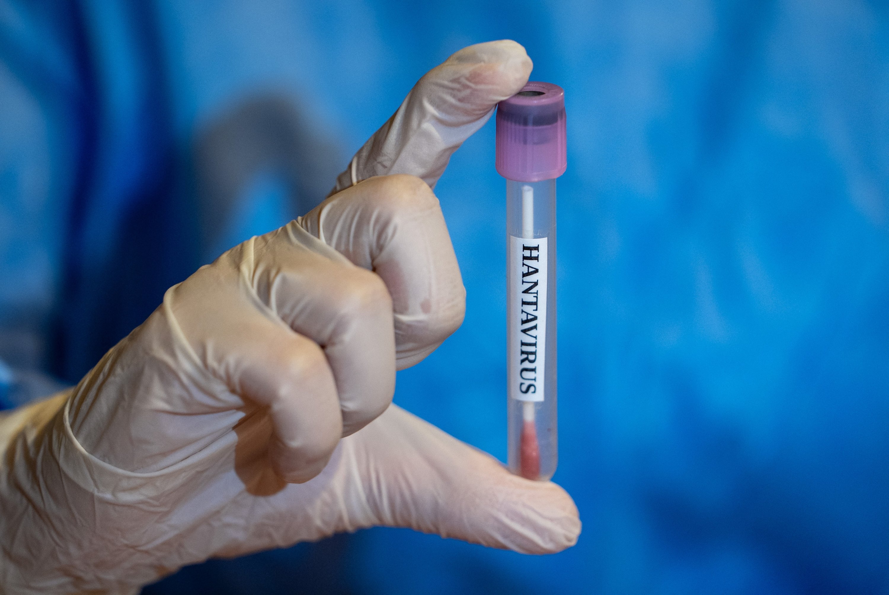 Türkiye’s Health Ministry says no hantavirus cases detected
