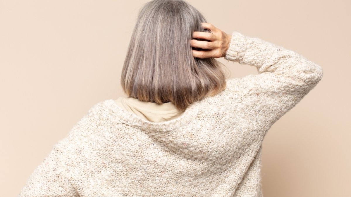 Stress gets the blame, but genetics decide when hair turns gray