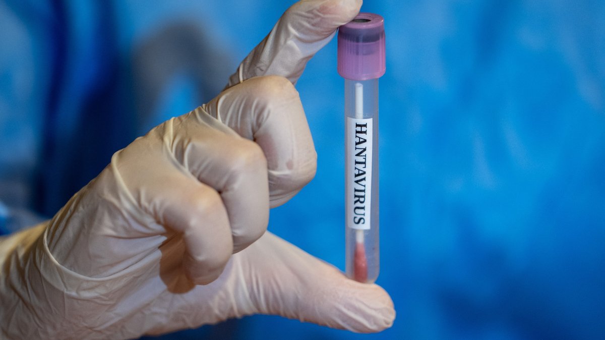  A laboratory test tube is seen during infectious disease monitoring efforts, May 7, 2026. (AA Photo) 
