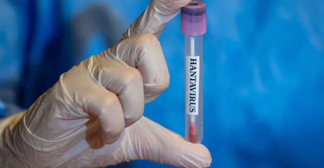  A laboratory test tube is seen during infectious disease monitoring efforts, May 7, 2026. (AA Photo) 