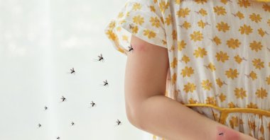 A young girl is riddled with mosquito bites. (Shutterstock Photo)