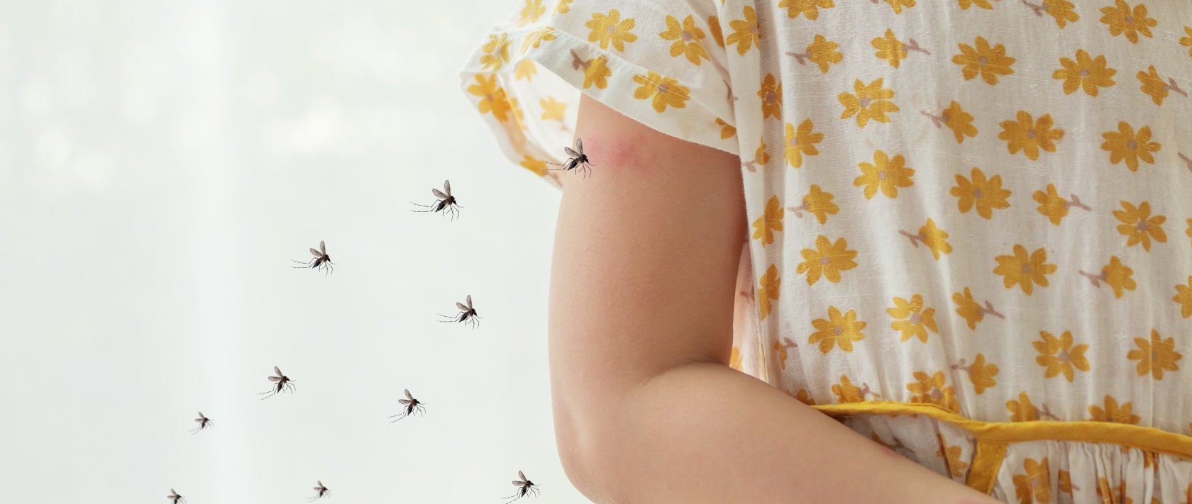 A young girl is riddled with mosquito bites. (Shutterstock Photo)