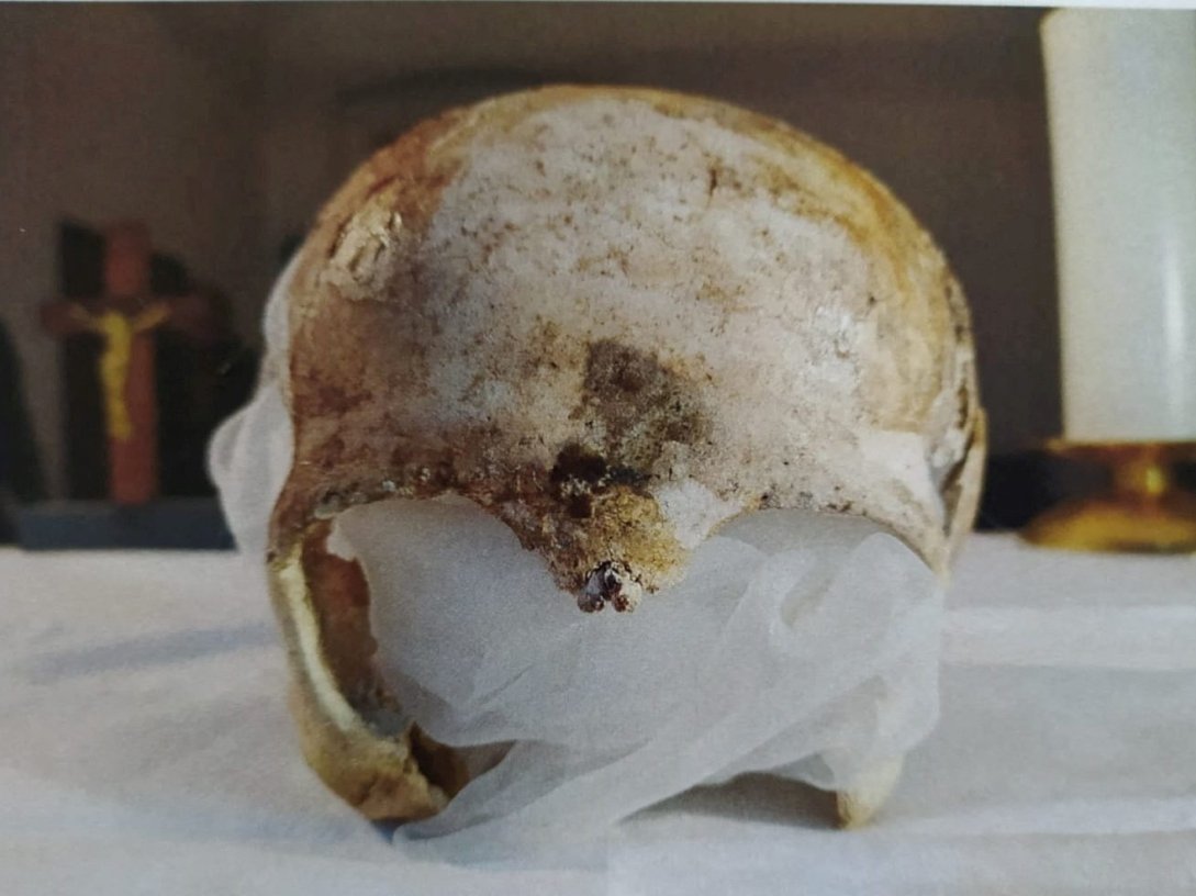 A picture of an 800-year-old skull, believed to be that of Saint Zdislava of Lemberk, in Jablonne v Podjestedi, Czech Republic, May 13, 2026. (Reuters Photo)