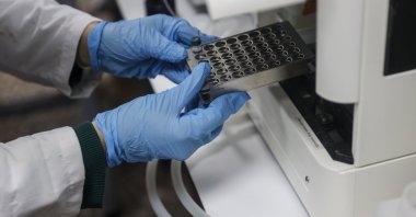 Samples from the Marmara Sea are being analyzed for plastics as part of a TÜBİTAK 1001 project, Türkiye, June 1, 2026. (AA Photo)