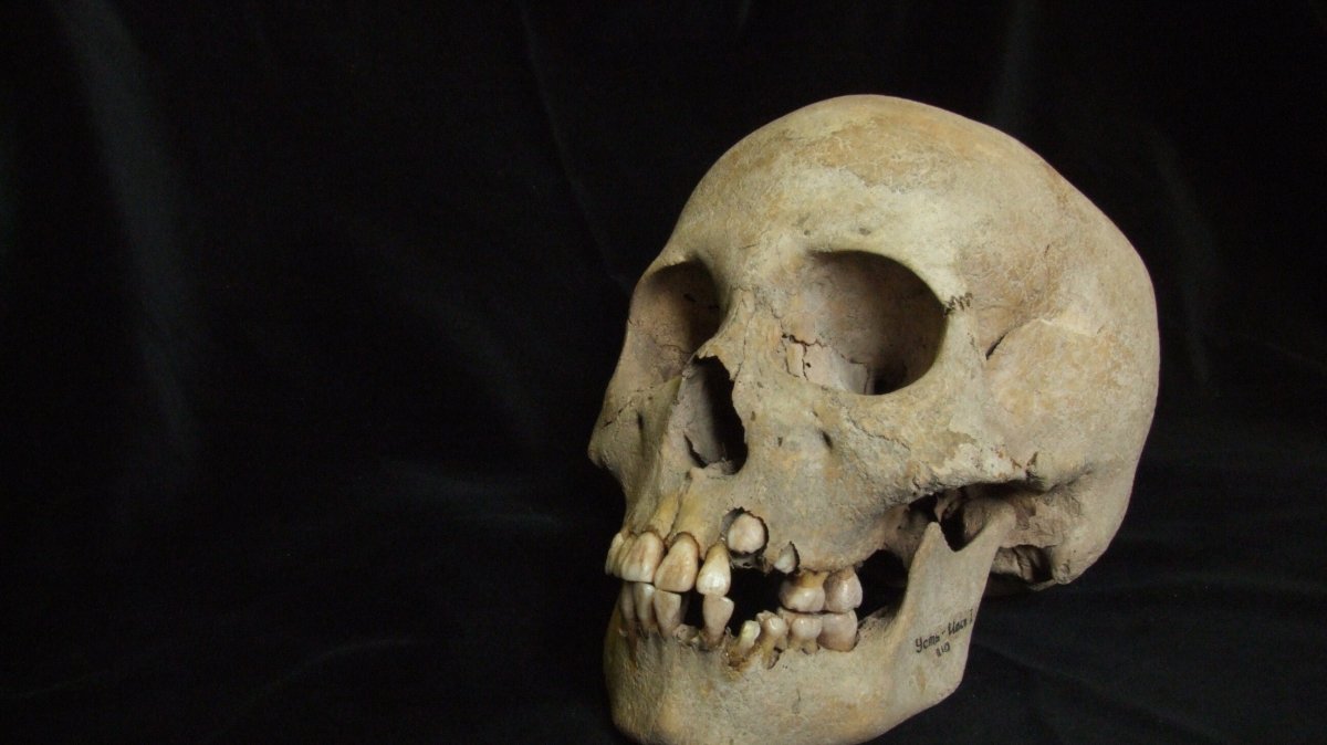 This 2006 image from Angela Lieverse shows the skull of a young girl who was buried with victims of the plague in Siberia.  (Angela Lieverse via AP)