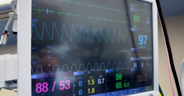 A hospital monitor tracks a patient's heart rate and vital signs during treatment. (Shutterstock Photo) 