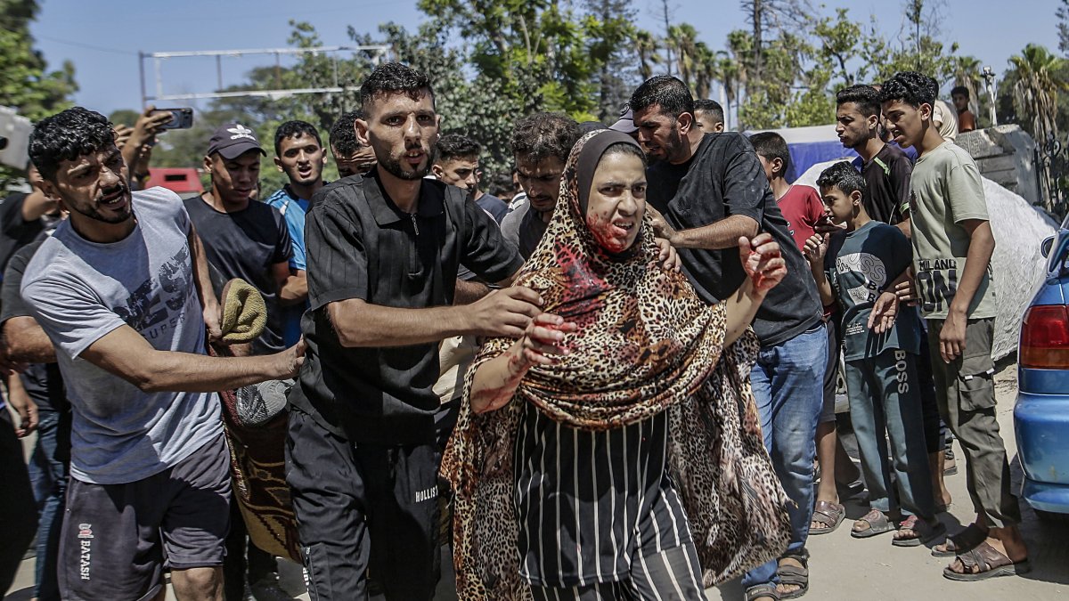 A Palestinian woman injured following an Israeli airstrike in Gaza City, Aug. 19, 2026. (EPA Photo)