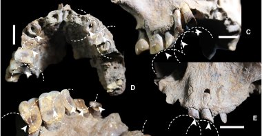  Drug use-related dental wear in early Sulawesi foragers, in this undated file photo published as part of research. (Science Advances Journal Handout) 