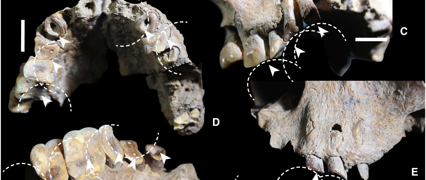  Drug use-related dental wear in early Sulawesi foragers, in this undated file photo published as part of research. (Science Advances Journal Handout) 