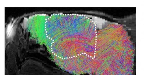 A map of estimated nerve-fiber pathways in the brain of a bioengineered “xenocortical” mouse with transplanted lab-grown human brain tissue, released by Stanford University in Stanford, California, U.S., Sept. 16, 2026. (Reuters Photo)