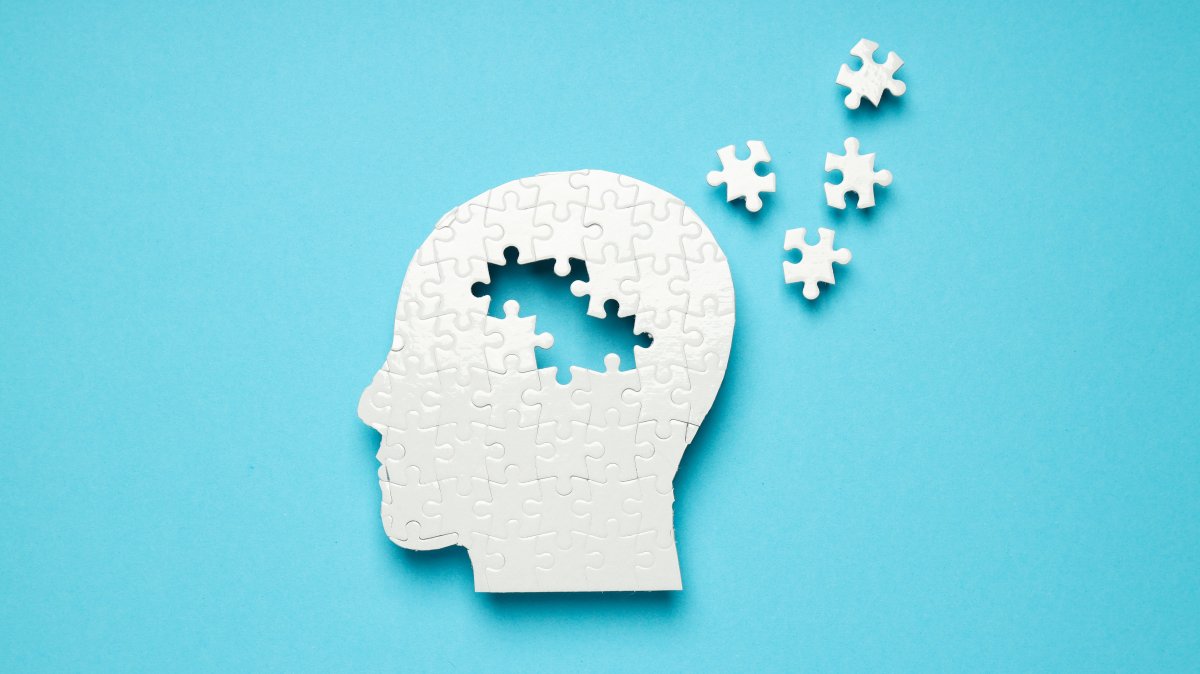 A puzzle shaped like a human head is pictured against a blue background, with several pieces scattered outside the outline, representing memory loss associated with Alzheimer’s disease. (Shutterstock Photo)