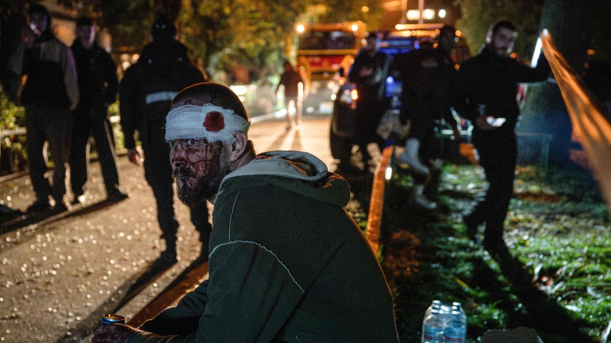 A wounded resident sits at the site of a Russian missile strike at an apartment building in Kyiv, Ukraine, Oct. 14, 2026. (AFP Photo)