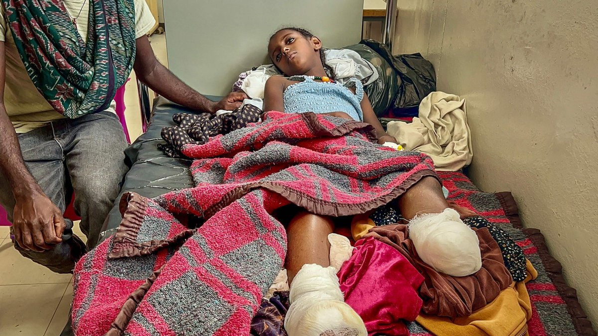 Iyerusalem lies on a hospital bed beside her father at Ayder Referral Hospital after heavy artillery shelling in Qarsole village led to the amputation of both her legs and the death of her brother, Mekelle, Ethiopia, Oct. 6, 2026. (AFP Photo)