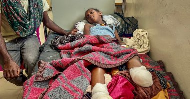 Iyerusalem lies on a hospital bed beside her father at Ayder Referral Hospital after heavy artillery shelling in Qarsole village led to the amputation of both her legs and the death of her brother, Mekelle, Ethiopia, Oct. 6, 2026. (AFP Photo)